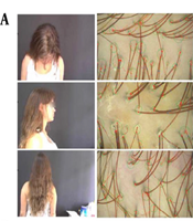 J Skin Stem Cell